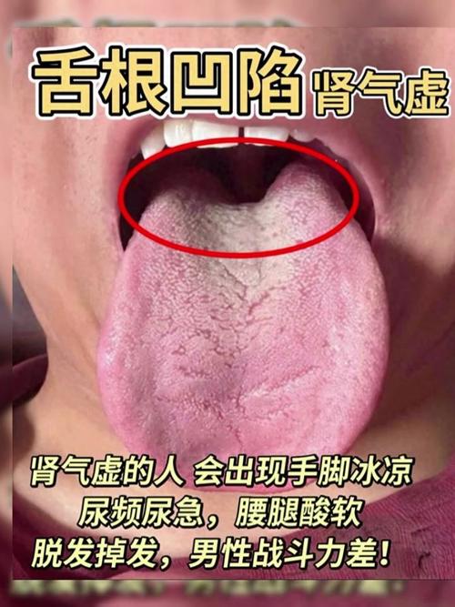 2025新澳门精准正版图库网站和舌根和牙龈被缝一起与舌根和牙龈被缝一起怎么办